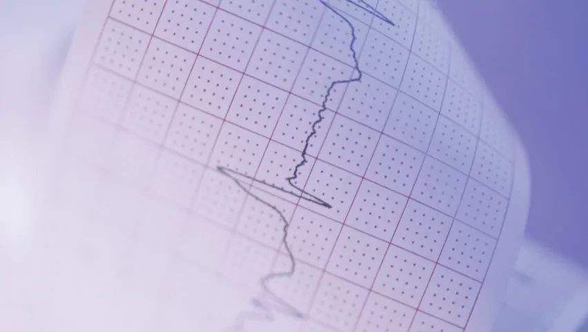 EKG-Kurve zur kardiologischen Diagnostik